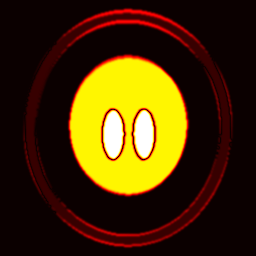 f4_bspline · |moving − fixed| (before)